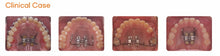 Load image into Gallery viewer, Palatal Screw (Ø1.8 x 16mm)
